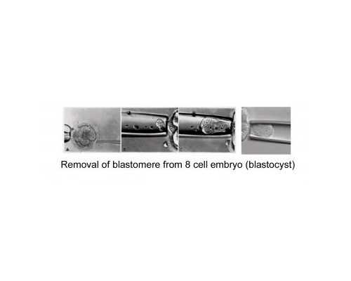 揭秘南京市妇幼试管婴儿费用与成功经验分享