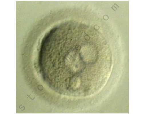 试管婴儿的连续性：能否多次进行？_国内高龄生育的挑战