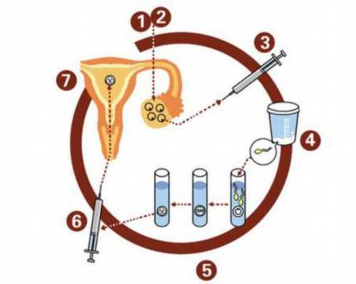 揭秘南京试管婴儿流程：周期详解与成功率分析