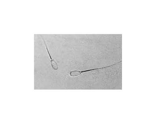 试管婴儿的真相：畸形率是否真的更高？