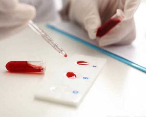 供卵女孩年龄的探讨与试管助孕费用的分析