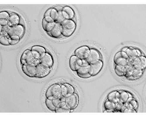 南京试管婴儿助孕：卵巢过度刺激腹水及出血影响移植的应对策略