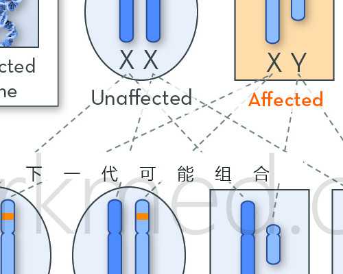 俄罗斯试管婴儿的不同方案解析