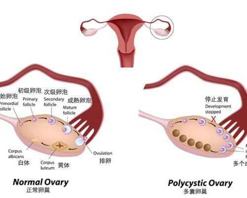 南京试管移植后出血怎么办？保胎成功经验分享